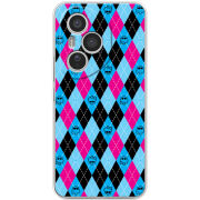 Чохол BoxFace Honor 400 Pro 