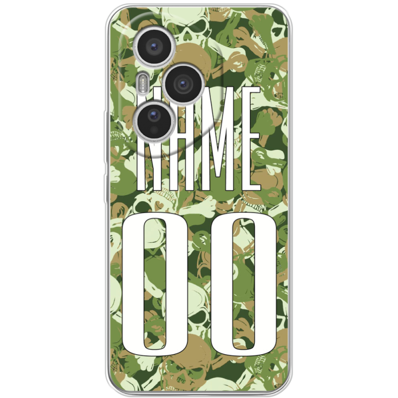 Чохол BoxFace Honor 400 Pro 