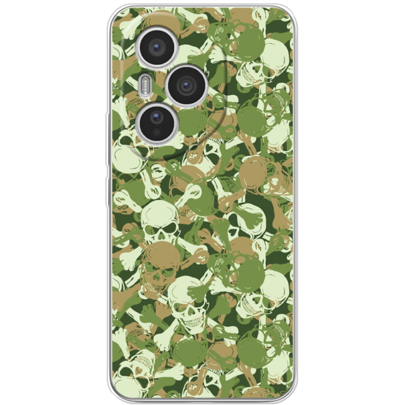 Чохол BoxFace Honor 400 Pro 