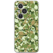 Чохол BoxFace Honor 400 Pro 