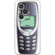 Чохол BoxFace Honor 400 Pro 