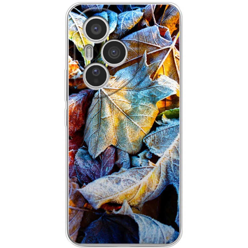 Чохол BoxFace Honor 400 Pro 