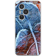 Чохол BoxFace Honor 400 Pro 