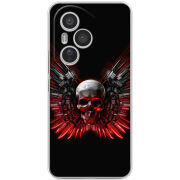Чохол BoxFace Honor 400 Pro 
