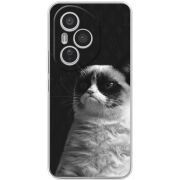 Чохол BoxFace Honor 400 Pro 