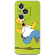 Чохол BoxFace Honor 400 Pro 