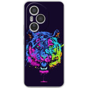 Чохол BoxFace Honor 400 Pro 