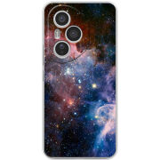 Чохол BoxFace Honor 400 Pro 