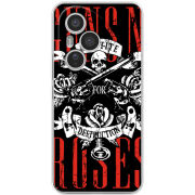 Чохол BoxFace Honor 400 Pro 