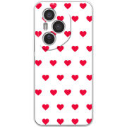 Чохол BoxFace Honor 400 Pro 