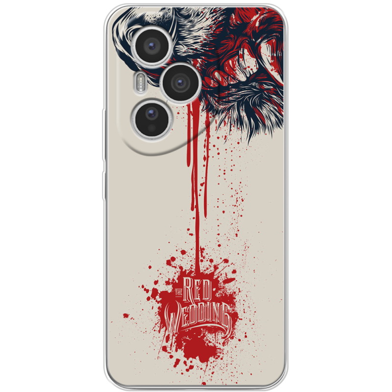 Чохол BoxFace Honor 400 Pro 