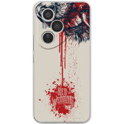 Чохол BoxFace Honor 400 Pro 