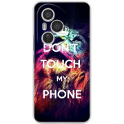 Чохол BoxFace Honor 400 Pro 