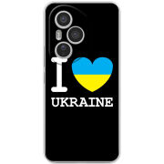 Чохол BoxFace Honor 400 Pro 