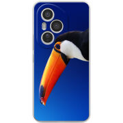 Чохол BoxFace Honor 400 Pro 