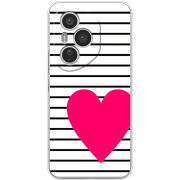 Чохол BoxFace Honor 400 Pro 