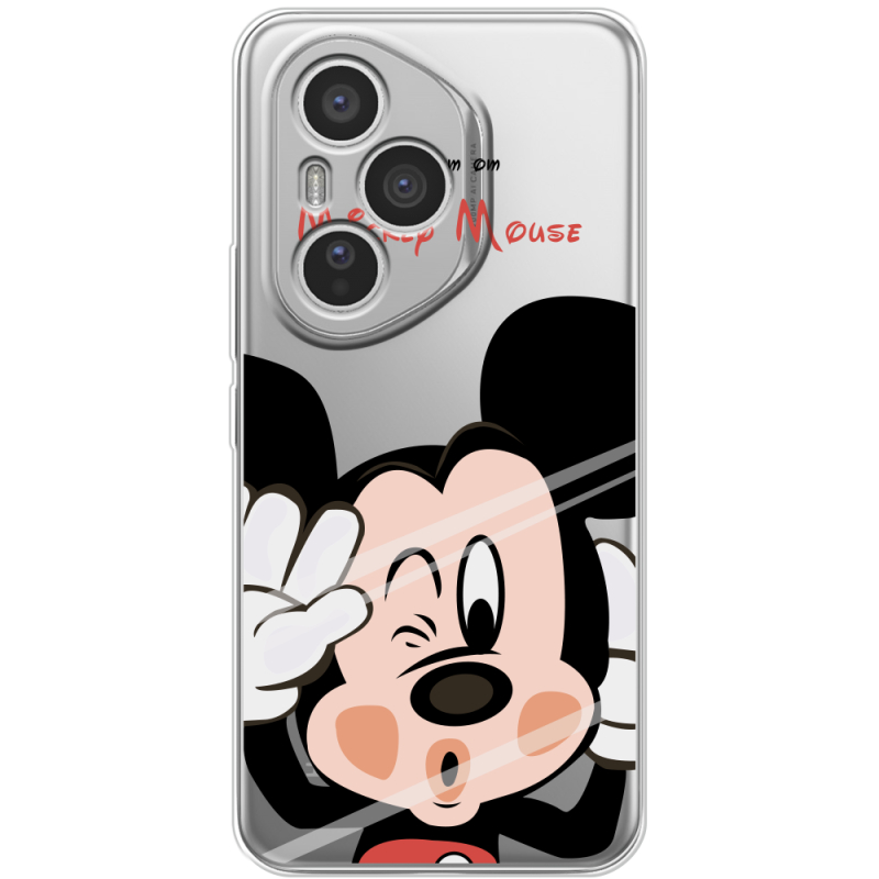 Прозорий чохол BoxFace Honor 400 Pro Mister M