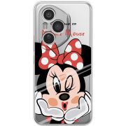 Прозорий чохол BoxFace Honor 400 Pro Lady M