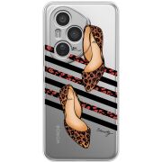 Прозорий чохол BoxFace Honor 400 Pro Love Beauty