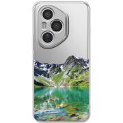 Прозорий чохол BoxFace Honor 400 Pro Green Mountain