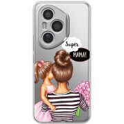 Прозорий чохол BoxFace Honor 400 Pro Super Mama and Daughter