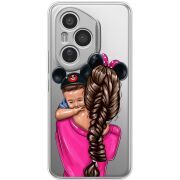 Прозорий чохол BoxFace Honor 400 Pro Mouse Mommy