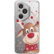 Прозорий чохол BoxFace Honor 400 Pro Winter Deer