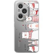 Прозорий чохол BoxFace Honor 400 Pro The Friendly Beasts