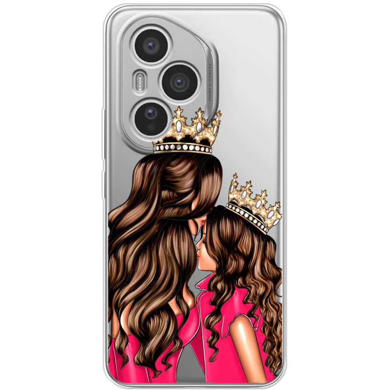 Прозорий чохол BoxFace Honor 400 Pro Queen and Princess