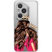 Прозорий чохол BoxFace Honor 400 Pro Queen and Princess