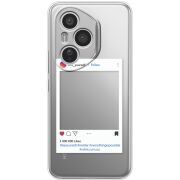 Прозорий чохол BoxFace Honor 400 Pro Insta