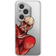 Прозорий чохол BoxFace Honor 400 Pro Титан