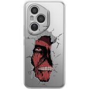 Прозорий чохол BoxFace Honor 400 Pro Нападение Титана