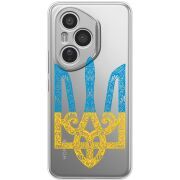 Прозорий чохол BoxFace Honor 400 Pro Gold Trident