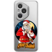 Прозорий чохол BoxFace Honor 400 Pro Cool Santa