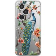 Прозорий чохол BoxFace Honor 400 Pro Pavlin