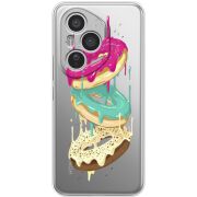 Прозорий чохол BoxFace Honor 400 Pro Donuts