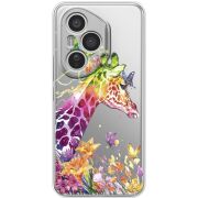 Прозорий чохол BoxFace Honor 400 Pro Colorful Giraffe