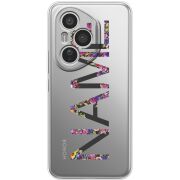 Прозорий чохол BoxFace Honor 400 Pro Именной