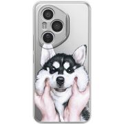 Прозорий чохол BoxFace Honor 400 Pro Husky