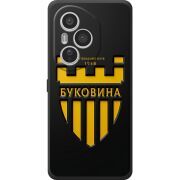 Чорний чохол BoxFace Honor 400 Pro 