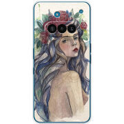 Чохол BoxFace Nothing Phone (3a) 