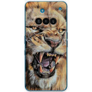 Чохол BoxFace Nothing Phone (3a) 