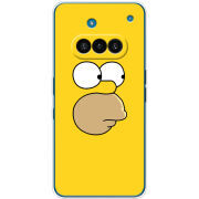 Чохол BoxFace Nothing Phone (3a) 