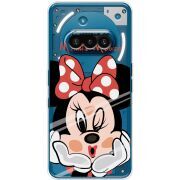 Прозорий чохол BoxFace Nothing Phone (3a) Lady M