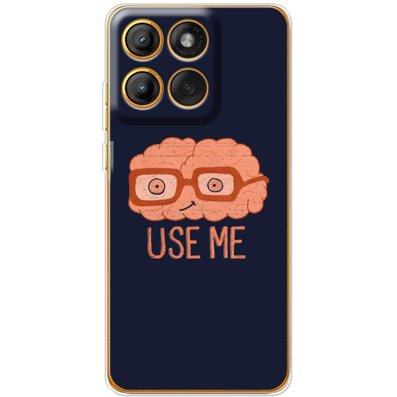 Чохол BoxFace Motorola Moto G86 