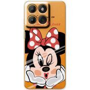 Прозорий чохол BoxFace Motorola Moto G86 Lady M