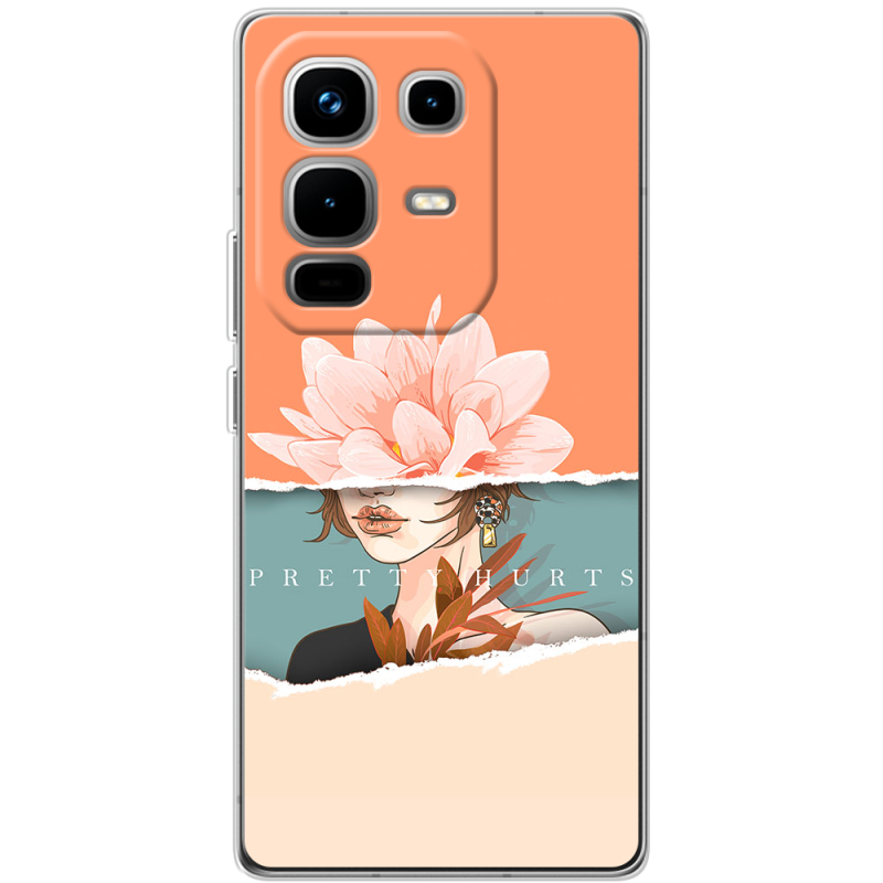 Чохол BoxFace Infinix Note 50 Pro Plus 