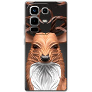 Чохол BoxFace Infinix Note 50 Pro Plus 