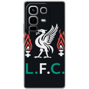 Чохол BoxFace Infinix Note 50 Pro Plus L. F. C.